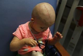 Brain Cancer Now Kills More Kids Than Leukemia