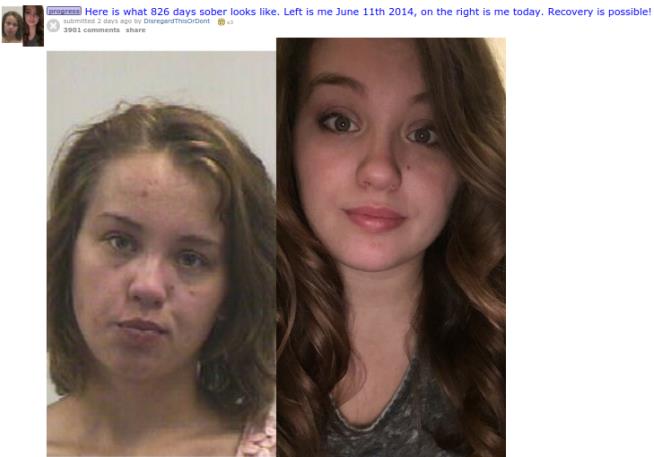 Selfie Shows Before and After of Heroin Addiction