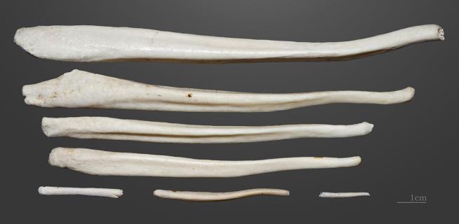 Scientists Figure Out Why Men Have No Penis Bone