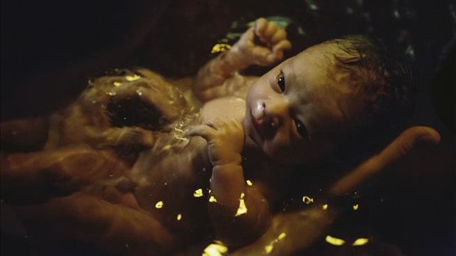Newborns Got Legionnaires' Disease in Birthing Tubs