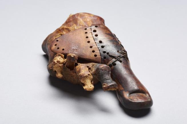 She Lost a Toe and Got a New One—3K Years Ago