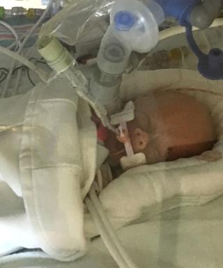 Baby Dies After Mom Gave Up Cancer Treatment to Save Her