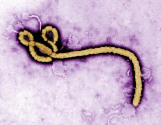 New Ebola Outbreak Confirmed in Congo