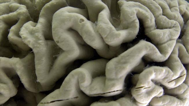 Teen Dies From Tapeworms in the Brain