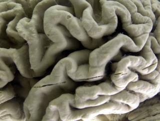 Teen Dies From Tapeworms in the Brain