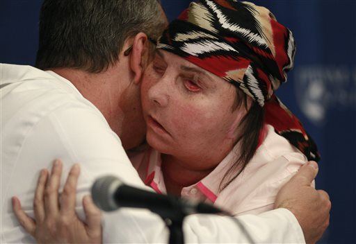 Woman Could Have a Second Face Transplant