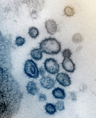 Coronavirus Stays Viable for Days on Plastic