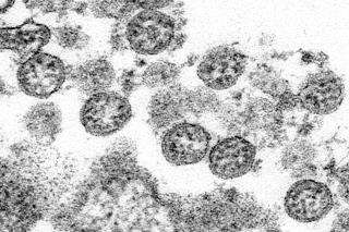 Mutation May be Increasing Coronavirus' Infectiousness