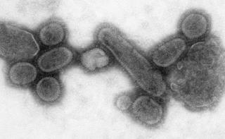 Oh, Great: A Flu Virus With 'Pandemic Potential' Discovered