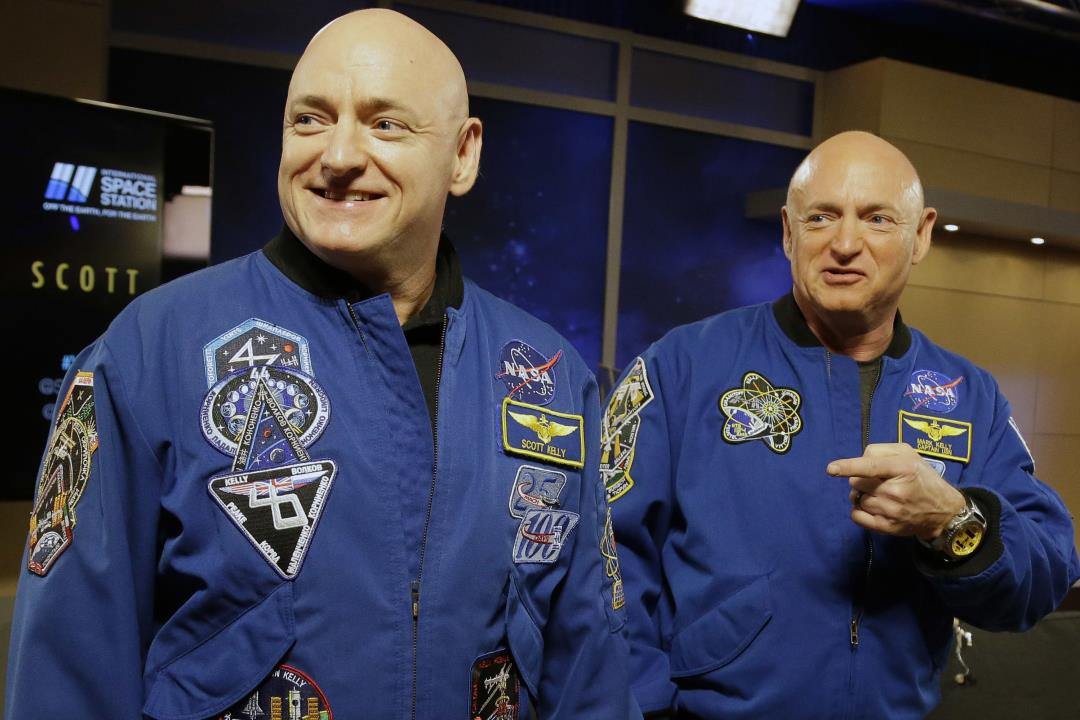 Scott Kelly’s body endured another surprise in space