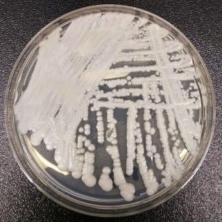 Superbug Fungus Spreading in 2 US Cities