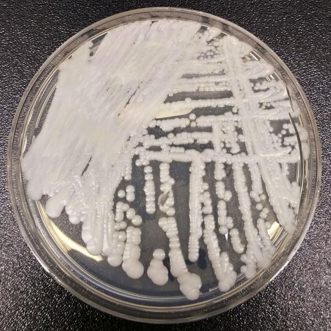 Superbug Fungus Found in Louisiana for First Time