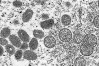 NYC Investigates Possible Monkeypox Case