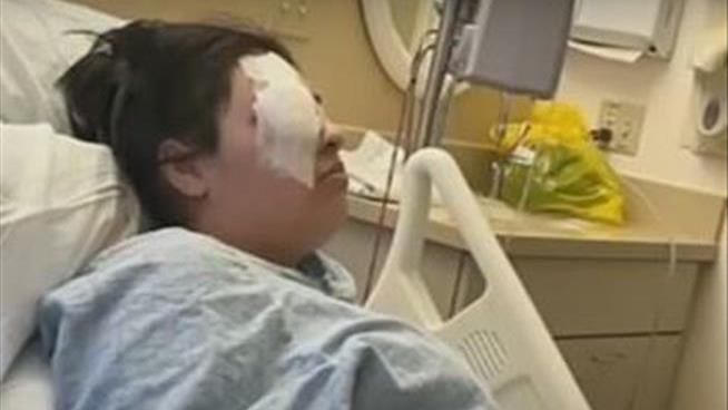 Police Announce Arrest 2 Weeks After Bully Knocked Out Teen's Eye