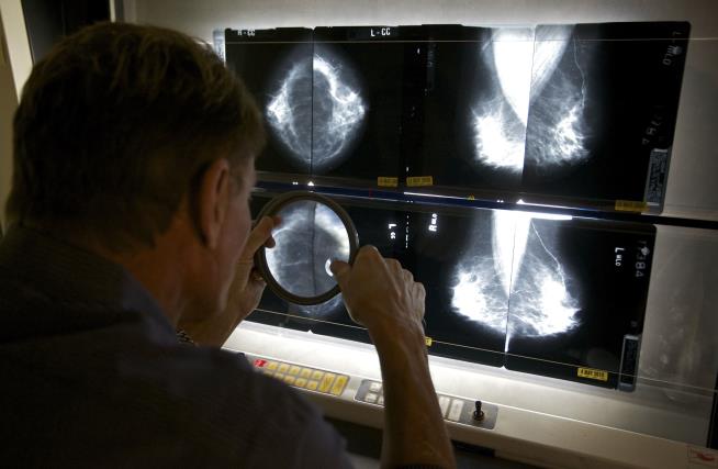 New Guidance: Start Mammograms at 40, Not 50