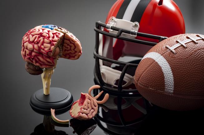 In Largest Brain Study of Young Athletes, a 'Remarkable' Find