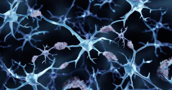 Four Proteins in Our Blood May Predict Alzheimer's