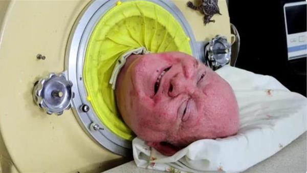 Man Who Lived Longest in Iron Lung Has Died