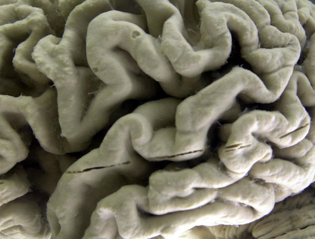 Nuestros cerebros son cada vez más grandes