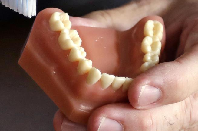 Want a New Set of Chompers? Beware 'Veneer Techs'