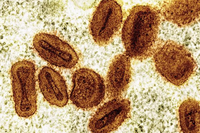 First Case of New Form of Mpox Confirmed in US