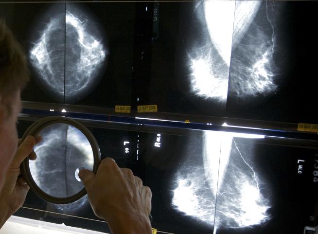 Cancer Hitting Women, Young People More Often