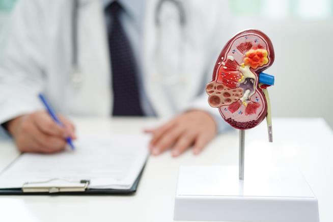 Donors Deserve Cash for Their Kidneys