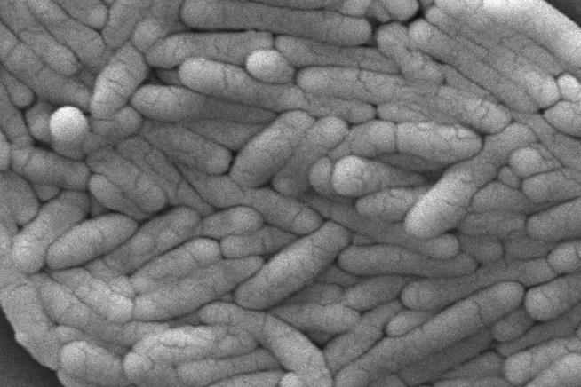 Salmonella Outbreak Sickens 7 in Multiple States