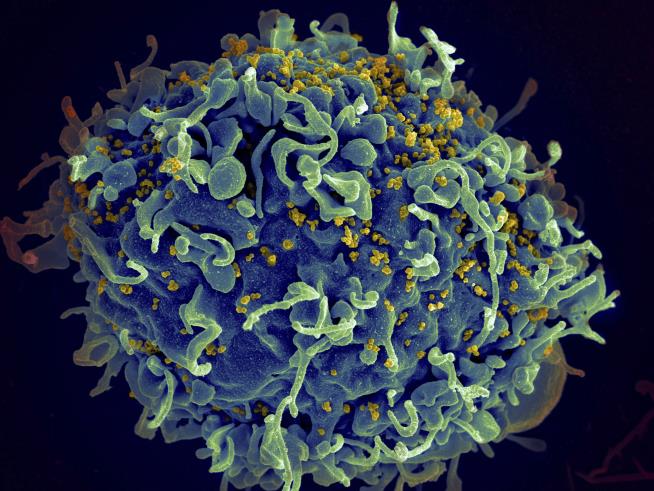 UN Assesses Impact of US Cuts on AIDS Fight
