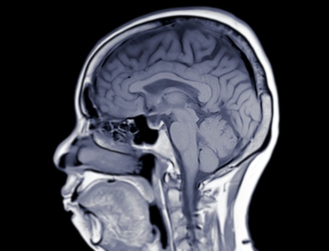 Some Mentally Ill Patients Abruptly Turn Sane