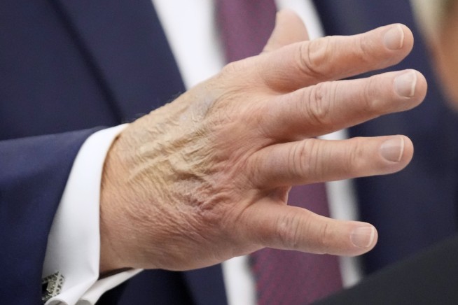 Trump Addresses the Rumors That He Was Dead