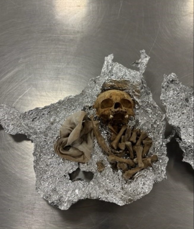Human Skull Found in Luggage During Tampa Airport Check