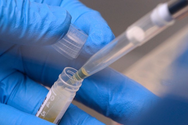 Cuts in NIH Funding Crash Down on 74K Study Subjects