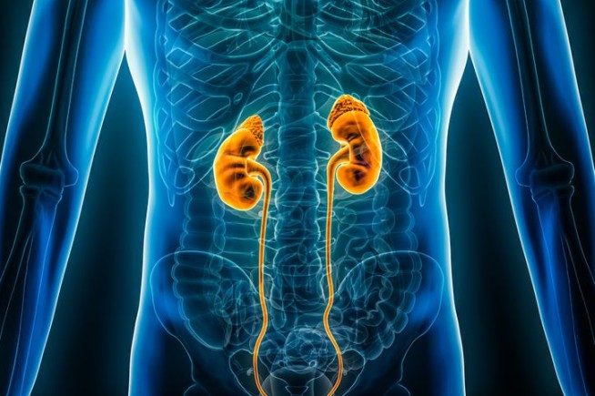 Chronic Kidney Disease Now a Top 10 Global Killer