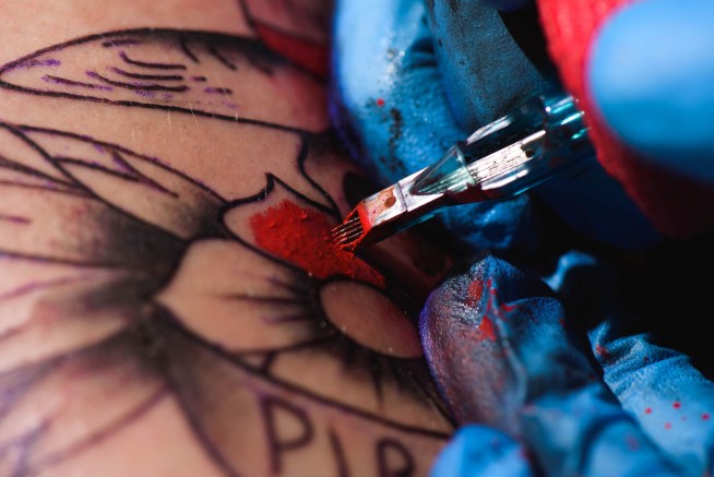 Man's Crazy Immune Reaction Tied to Red Tattoo Ink