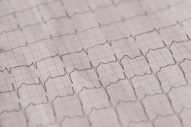 Early Menopause Linked to Higher Heart Risk