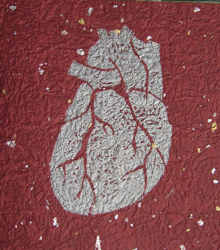 Stents Show No Lasting Benefit In Heart Study