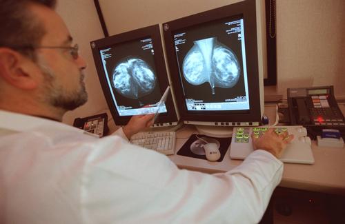 Docs Tell Younger Women: Avoid Mammograms