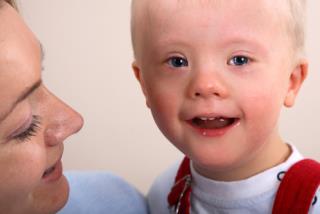 Down Syndrome Gene Holds Cancer Clue