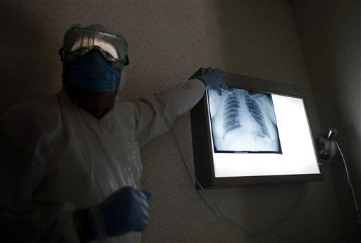 Swine Flu Can Burrow Deep Into Lungs: Docs