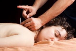 Scientists Try to Solve the Mystery of Acupuncture