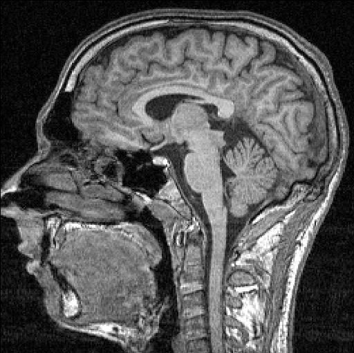 Lie-Detecting Brain Scan May Debut in Court
