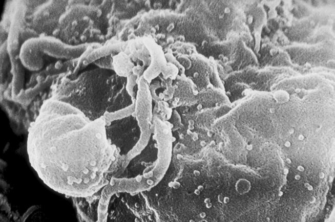 Smallpox Vaccine Slows HIV