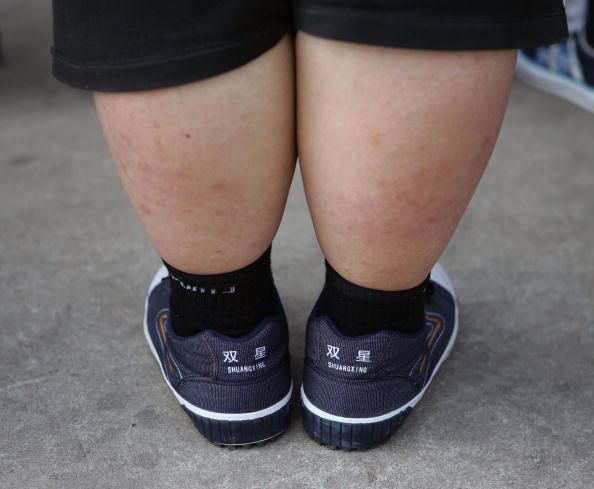 Childhood Obesity Epidemic Linked to Virus