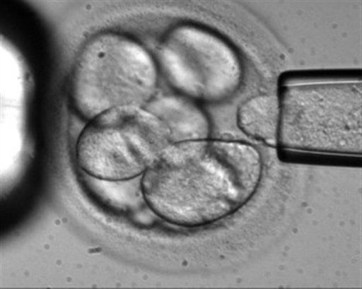 Experts Weigh 3-Parent Test Tube Babies