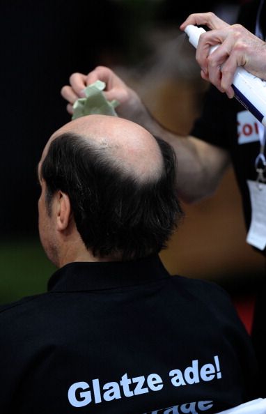 Men on Finasteride Trade Baldness for Erectile Dysfunction