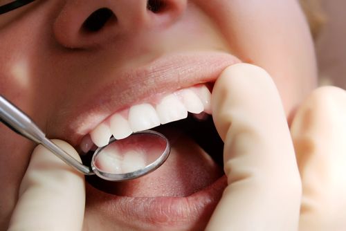 Dental Health: Cavities Can Be Contagious