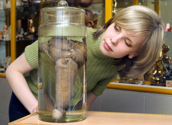 Finally, a Human Specimen for Iceland Penis Museum
