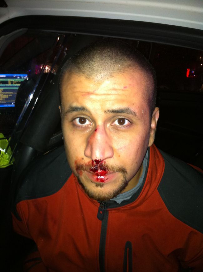 Bloody Zimmerman Appears in Color Photo
