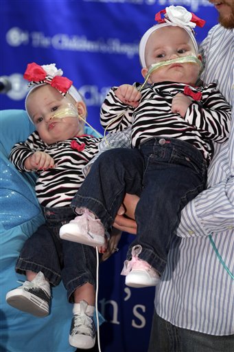 Once-Conjoined Twins Make Debut at Pa. Hospital